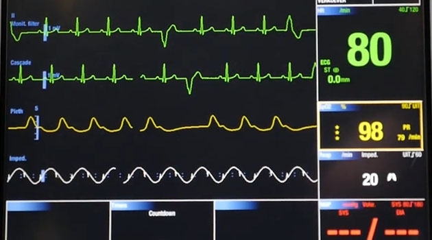 The new study demonstrates that an AI is capable of automatically diagnosing the abnormalities indicated by an ECG.