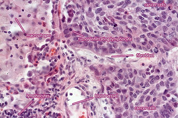 Microscope image of different cell types shown i different pink and purple shades.