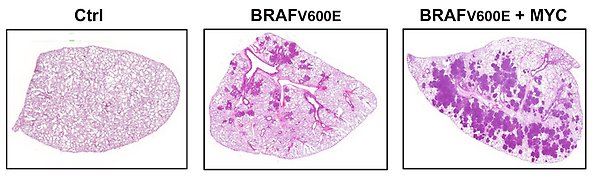 MYC accelererar BRAFV600E-driven lungtumörutveckling i möss.