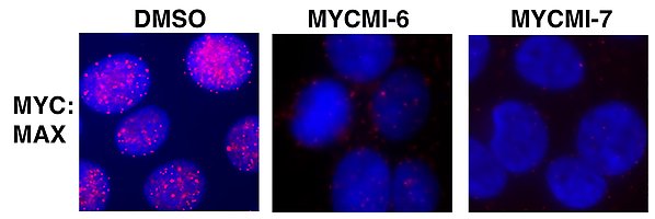 Inhibition av MYC/MAX-interaktion i celler med de små molekylerna MYCMI-6 och MYCMI-7 såsom visualiserat med hjälp av isPLA