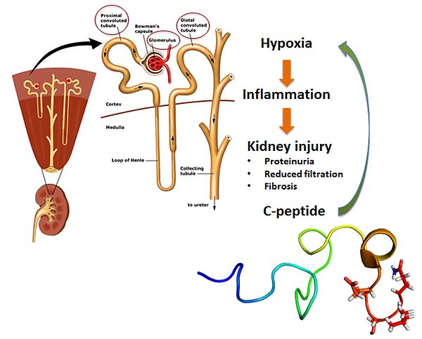 Illustration of the different parts of the kidney and the relationship between C-peptides, hypoxia, inflammation and kidney damage.