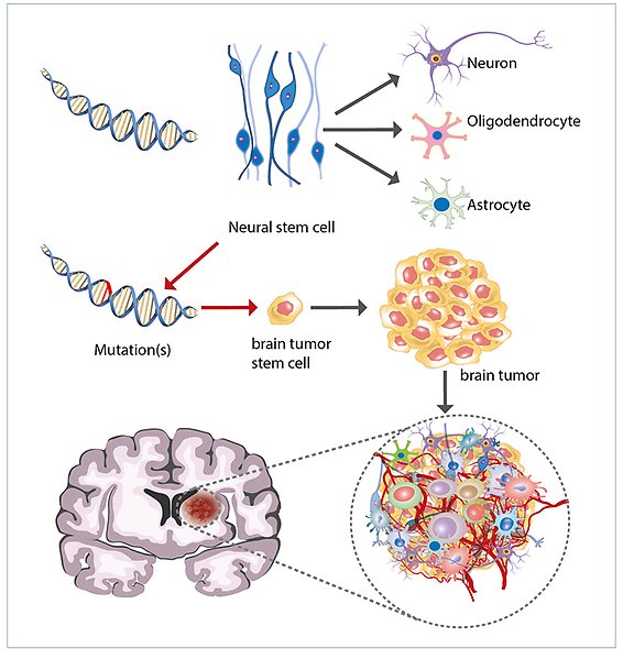 Teckningar av olika sorters nervceller, dna, hjärntumörceller och en hjärna, som illustrerar hur hjärntumörer uppstår genom mutationer i hjärnceller. 