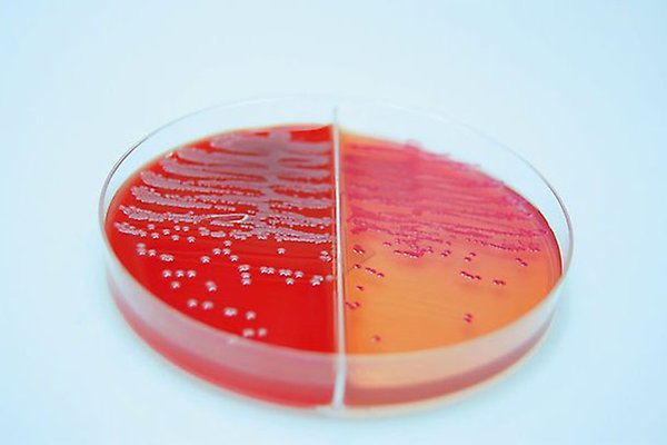 An agar plate where something is growing.