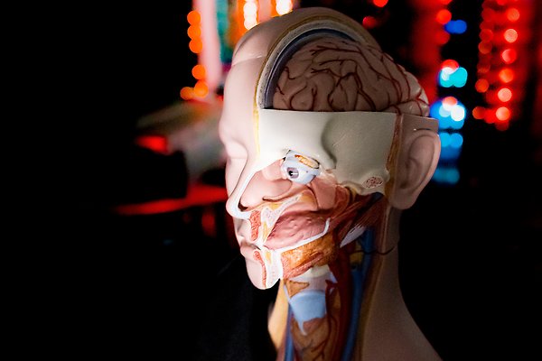 Upper part of a human model showing muscles, tendons and blood vessels.