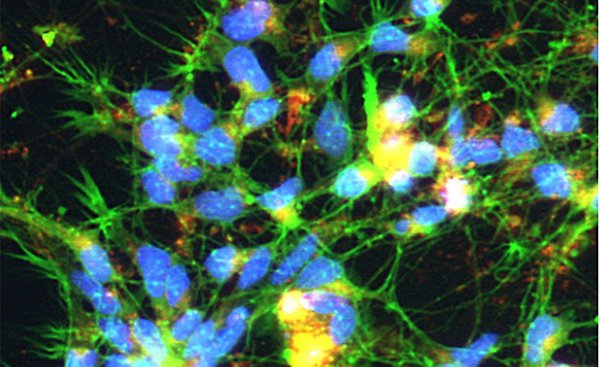 Microscope image of neurons stained in yellow, green and blue. 
